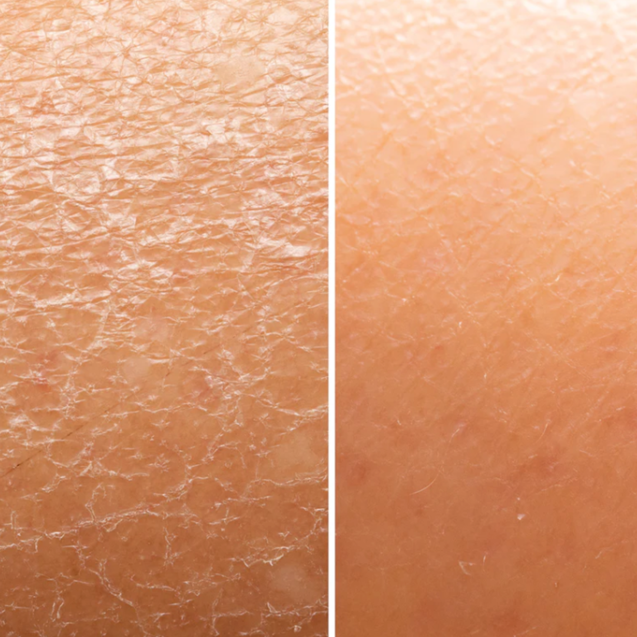 How Aloe Vera Can Help Soothe and Relieve Dry Skin