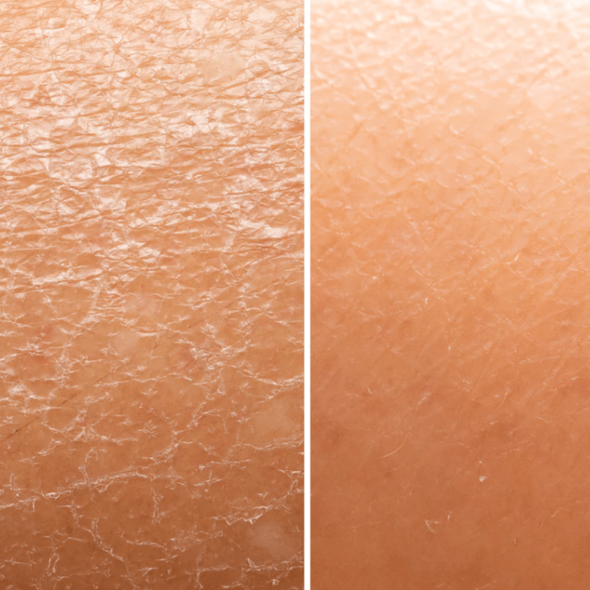 How Aloe Vera Can Help Soothe and Relieve Dry Skin - Anoki