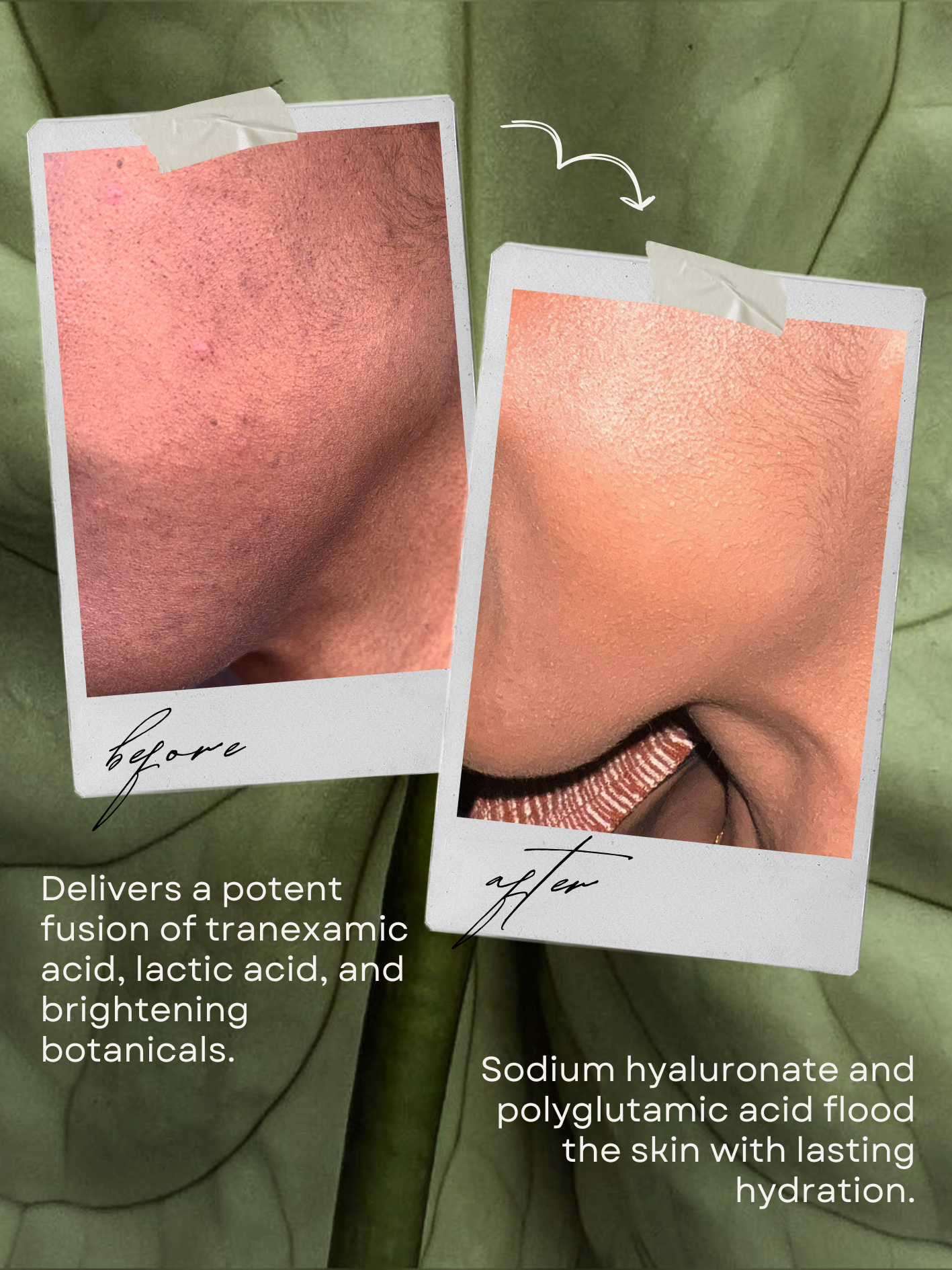 Brightening serum for dark spots